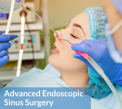 images/Services/Services-SinusSurgery.jpg#joomlaImage://local-images/Services/Services-SinusSurgery.jpg?width=300&height=268